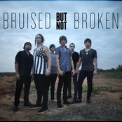 Bruised But Not Broken - List pictures