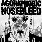 Agoraphobic Nosebleed - List pictures