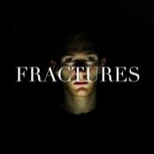 Fractures - List pictures